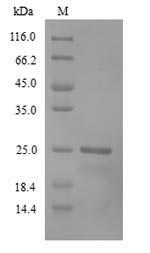 Recombinant Human Recoverin(RCVRN)