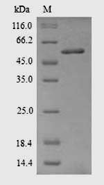 Recombinant Rattus norvegicus Acetyl-CoA carboxylase 1(Acaca),partial