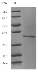 Recombinant Human Glutaminase kidney isoform, mitochondrial(GLS),partial