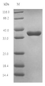 Recombinant Human Oncostatin-M(OSM),partial