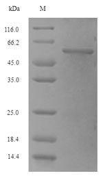 Recombinant Phosphoribosylamine--glycine ligase(purD)