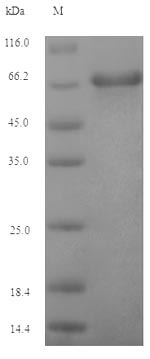 Recombinant Epstein-Barr virus Envelope glycoprotein GP350(BLLF1),partial