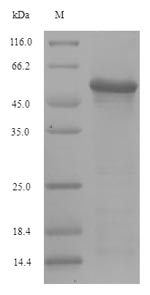 Recombinant Influenza A virus Hemagglutinin(HA) ,partial