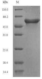 Recombinant Rat Acetyl-CoA carboxylase 1(Acaca) ,partial