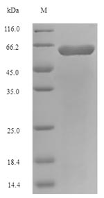 Recombinant Long-chain fatty acid transport protein(fadL)