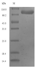 Recombinant Human Glutaminase liver isoform, mitochondrial(GLS2)