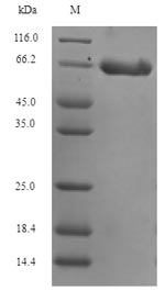 Recombinant Human Neuronal migration protein doublecortin(DCX)