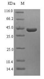 Recombinant Mouse 40S ribosomal protein S3(Rps3)
