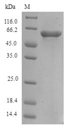 Recombinant Human Protein FAM46C(FAM46C)
