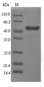 Recombinant Rat Galectin-4(Lgals4)