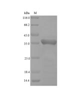 Recombinant Charybdis feriatus Tropomyosin