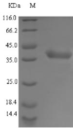 Recombinant Staphylococcus aureus L-lactate dehydrogenase 1(ldhA)