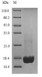 Recombinant Mouse Complement receptor type 2(Cr2),partial