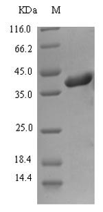 Recombinant Epstein-Barr virus Envelope glycoprotein H(gH),partial