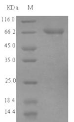 Recombinant Human Acyl-CoA synthetase family member 2, mitochondrial(ACSF2)