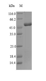Recombinant Naja mossambica Snake venom metalloproteinase-disintegrin-like mocarhagin