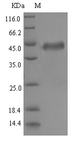 Recombinant Epstein-Barr virus Envelope glycoprotein B(gB),partial