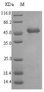Recombinant Pseudomonas aeruginosa Pseudolysin(lasB),partial
