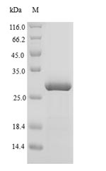 Recombinant Anas platyrhynchos Lysozyme C-1