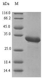 Recombinant Betula pendula Profilin(BETVII)