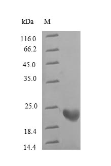 Recombinant Human Rho guanine nucleotide exchange factor 18(ARHGEF18),partial