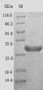 Recombinant Gadus morhua Parvalbumin beta