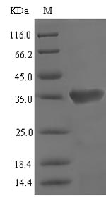 Recombinant Mouse Vomeronasal secretory protein 1(Lcn3)