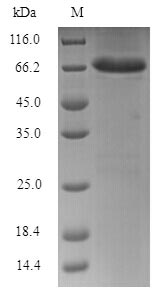 Recombinant Junin arenavirus Nucleoprotein(N)