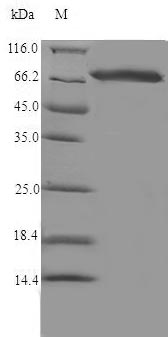 Recombinant Rat Steroid 17-alpha-hydroxylase/17,20 lyase(Cyp17a1)