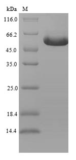 Recombinant Human GDNF family receptor alpha-like(C6orf144),partial