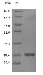 Recombinant Human Interferon gamma(IFNG)