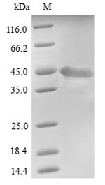 Recombinant Human Protein FAM46C(FAM46C)
