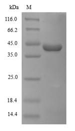 Recombinant Zaire ebolavirus Pre-small/secreted glycoprotein(GP),partial