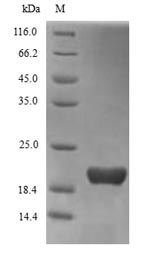 Recombinant Human Triggering receptor expressed on myeloid cells 2(TREM2),partial