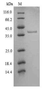 Recombinant Human Tyrosine-protein kinase JAK1(JAK1),partial
