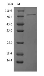 Recombinant Human Protein phosphatase 1 regulatory subunit 15A(PPP1R15A),partial