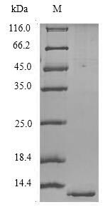 Recombinant Human Orexin receptor type 2(HCRTR2),partial