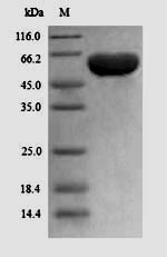 Recombinant Human Peroxisome prolifeRator-activated receptor gamma(PPARG)