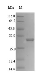 Recombinant Actinidia deliciosa Bet v 1 related allergen(ypr-10)