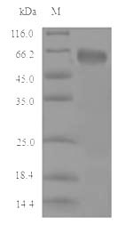 Recombinant Mouse Cystathionine beta-synthase(Cbs)