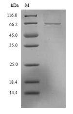 Recombinant Lassa virus Nucleoprotein(N)
