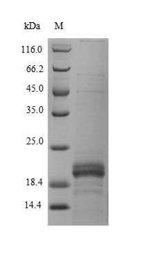 Recombinant Human Zymogen granule protein 16 homolog B(ZG16B)