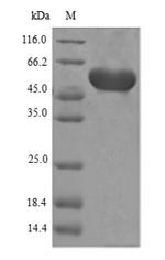 Recombinant Agrobacterium sp.3-phosphoshikimate 1-carboxyvinyltransferase(aroA)