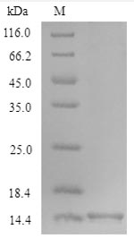 Recombinant Mouse Oncomodulin(Ocm)