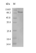 Recombinant Human Kinesin light chain 3(KLC3)