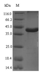 Recombinant Rat Complement C1q subcomponent subunit A(C1qa)