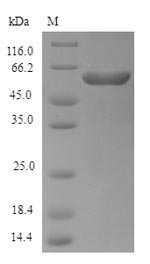 Recombinant Escherichia coli Exopolyphosphatase(ppx)