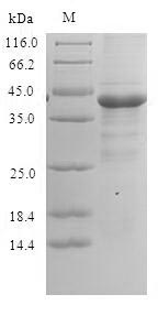 Recombinant Human Peptidyl-prolyl cis-trans isomerase A-like 4A/B/C(PPIAL4A)