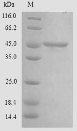 Recombinant Human Chitinase domain-containing protein 1(CHID1)