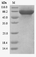 Recombinant Human Kinesin light chain 3(KLC3)